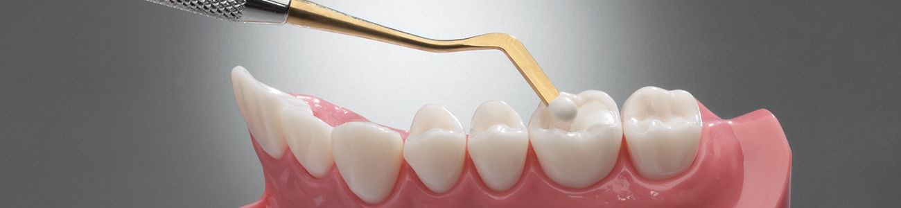 کامپوزیت و لایت کیور دندانپزشکی