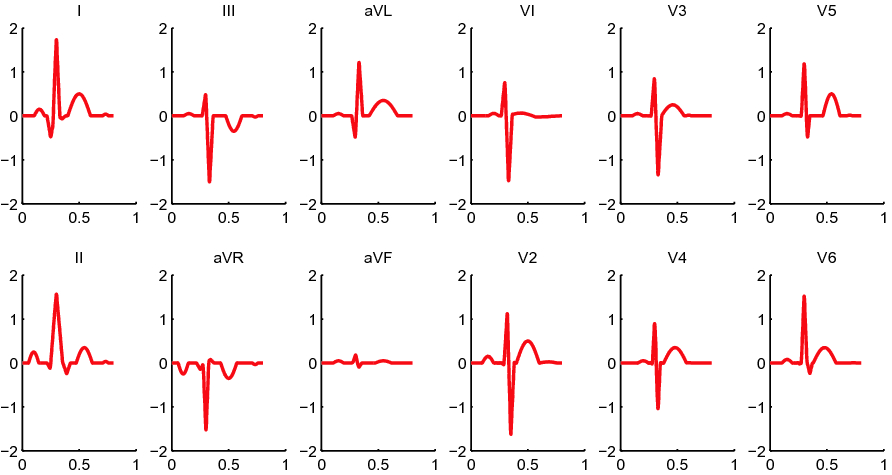 سیگنال ecg