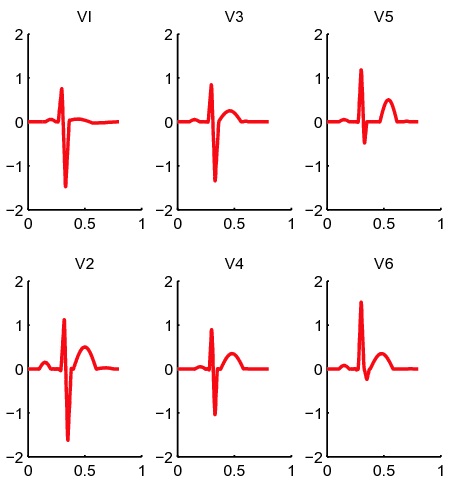 آموزش دستگاه نوار قلب ECG