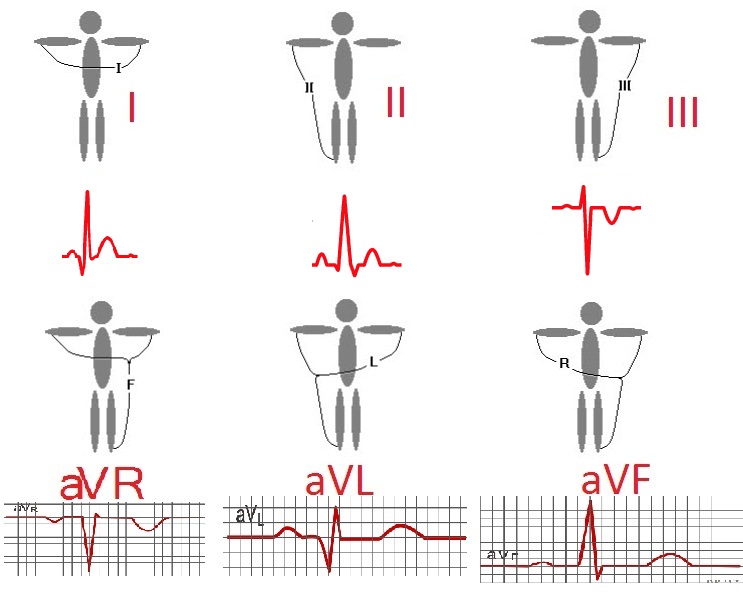 سیگنالهای نوار قلب دستگاه ecg