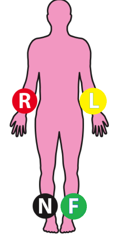 نحوه اتصال الکترودهای گیره ای نوار قلب ecg