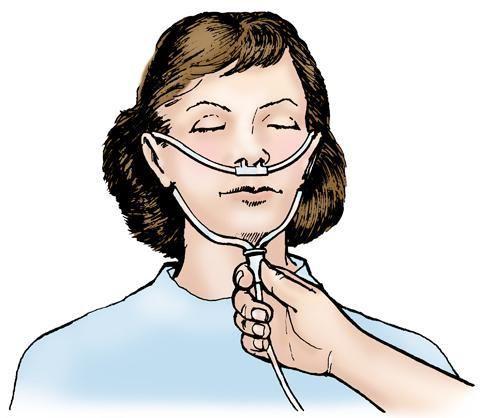 نحوه اتصالات کانولا اکسیژن